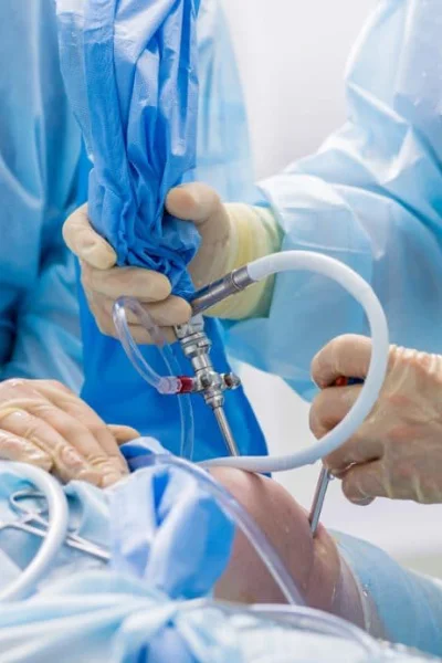 Chirurgie arthroscopique Tunisie